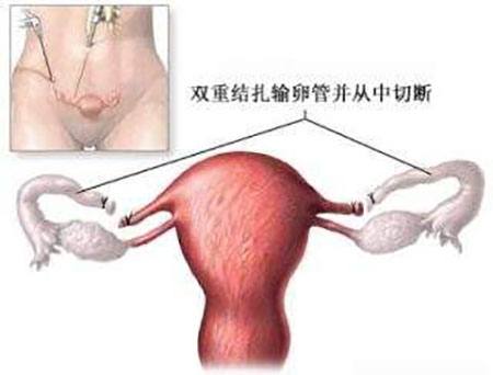 你听到我的心声了是什么意思,输卵管独白