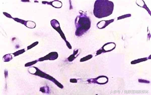 不小心踩到铁钉了怎么办,踩了锈钉子打了破伤风就没事了吗