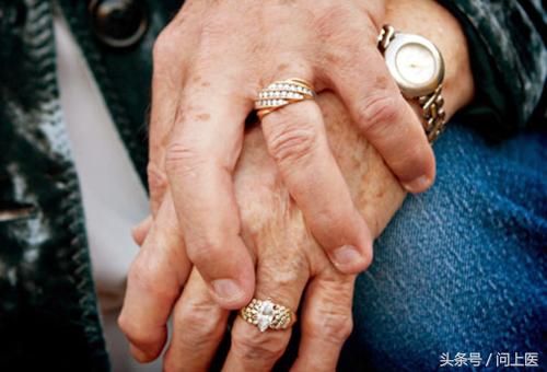 类固醇类药物有哪些危害,类固醇类药物治疗什么病