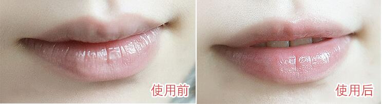 木瓜膏为什么这么神奇,澳洲木瓜膏都有哪些明星在用