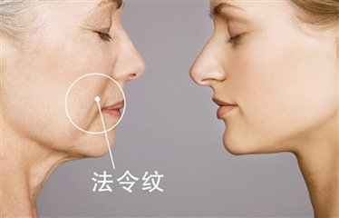 女生20多岁法令纹有点明显面相,面相脸上有一道和法令纹平行的沟