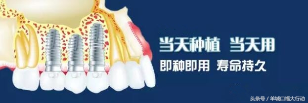 钛金种植牙的危害,正畸种植牙的危害