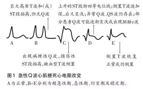护士夜班遇到急诊病人该怎么处理,急诊胸痛病人
