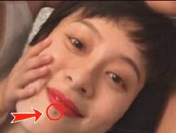 痣解析女面部,女性痣的全面解释视频