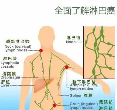 夺走高仓健、罗京的淋巴瘤，究竟是什么鬼？（附三甲医院名单）