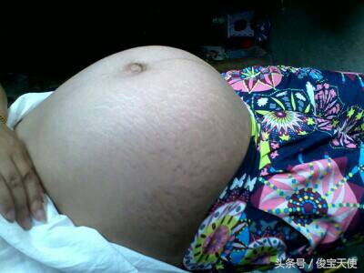 37周了突然皮肤瘙痒,怀孕37周身体瘙痒睡不着