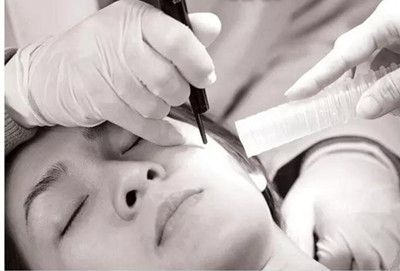 激光祛斑后怎么避免黑色素,激光祛斑后黑印子多久消失