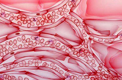 弱激光治疗心脑血管病,弱激光体外治疗仪器