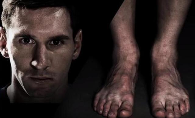 看脚就知道他们为什么是球坛巨星，詹姆斯完全变形，C罗脚趾发肿