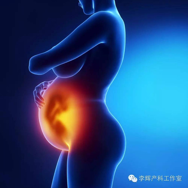 产科医生谈羊水过少,产科医生谈羊水栓塞