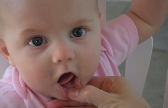 宝宝长牙会引发高烧吗,宝宝长牙你应该知道的事