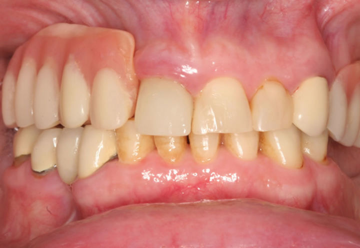 牙医如何快速知道你哪颗牙齿痛,牙齿痛小常识