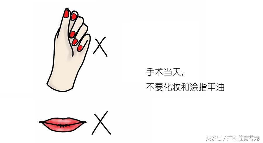 卫生部人工流产术操作教学,微管可视无痛人工流产术全过程