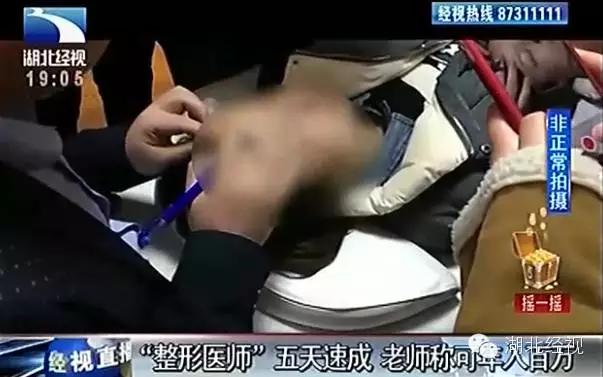 惊爆|深喉揭内幕：武汉所有微整形工作室都是无证经营