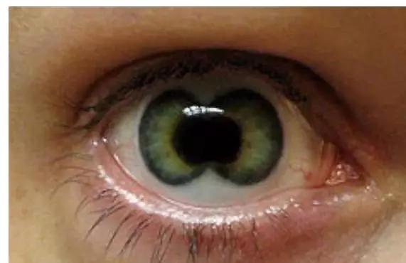 全世界奇葩美瞳,盘点那些奇葩美瞳