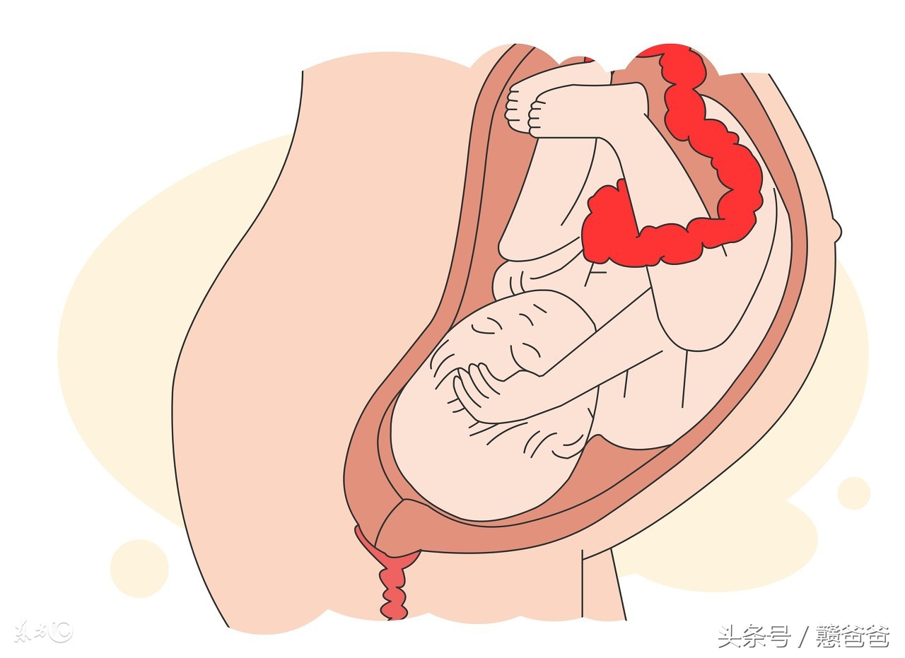 怀孕34周出现宫缩会早产吗,孕35周宫缩频繁是要早产吗