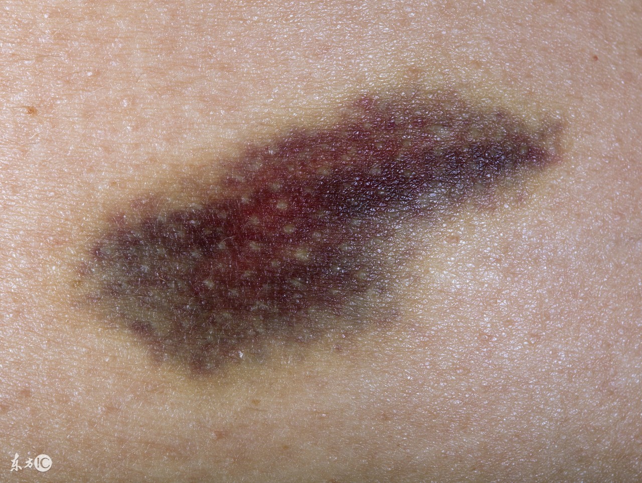 拍打肚子最有效的方法,备孕期间按压肚子疼痛