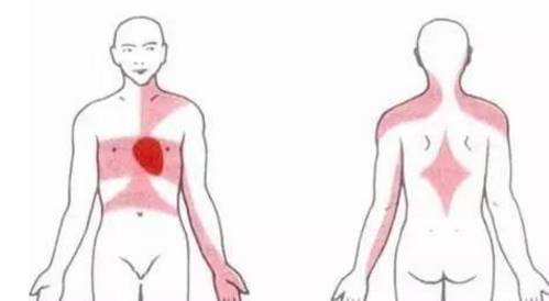 腰背放射性疼痛是什么原因,放射性疼痛的意思