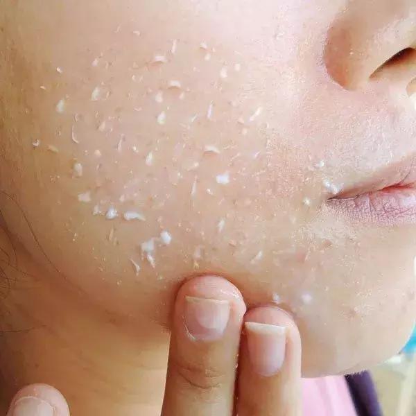 「面膜小知识」敷完面膜后涂霜会搓泥怎么办?