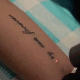 激光洗纹身需要修复吗,纹身后悔了怎么办啊