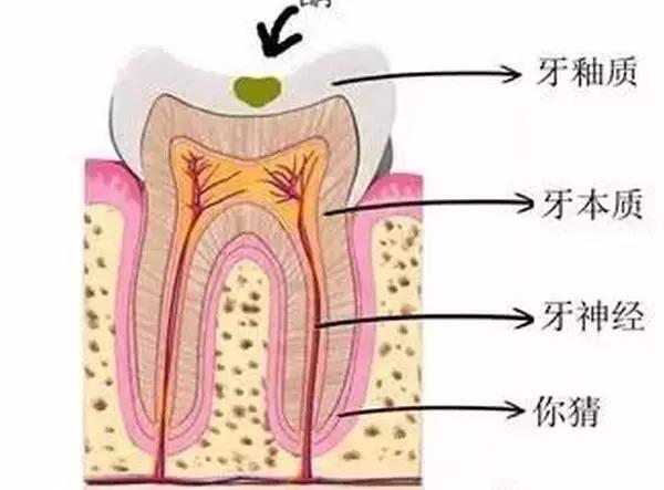 牙齿上的小坑需要补吗,牙齿上面全是被虫子咬的小洞洞