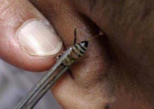 世界上有哪些能治病的方法,在中国有什么奇怪治病方法