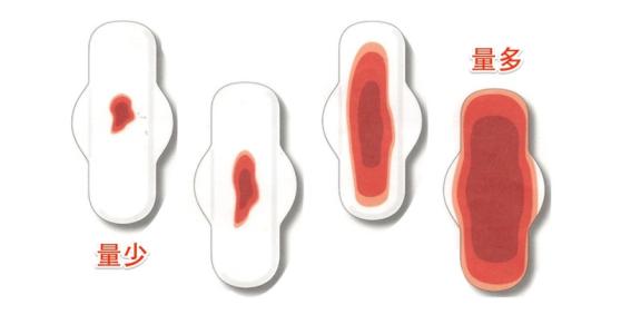 小产后月经量少怎么回事,产后月经量少褐色血怎么回事