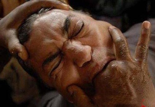 世界上有哪些能治病的方法,在中国有什么奇怪治病方法