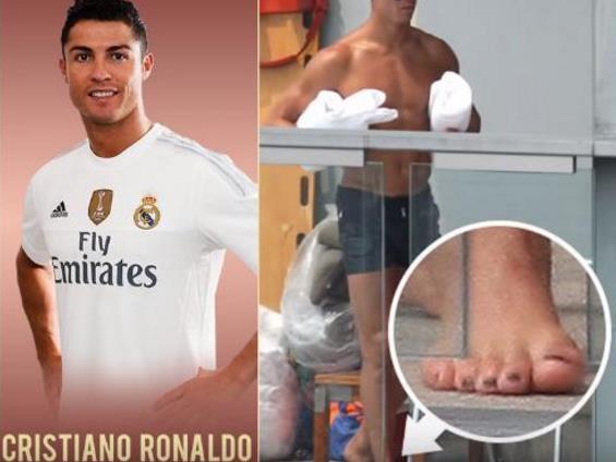 看完科比的手、詹姆斯的脚趾、郑智的肚子，大家就知道何为伟大了