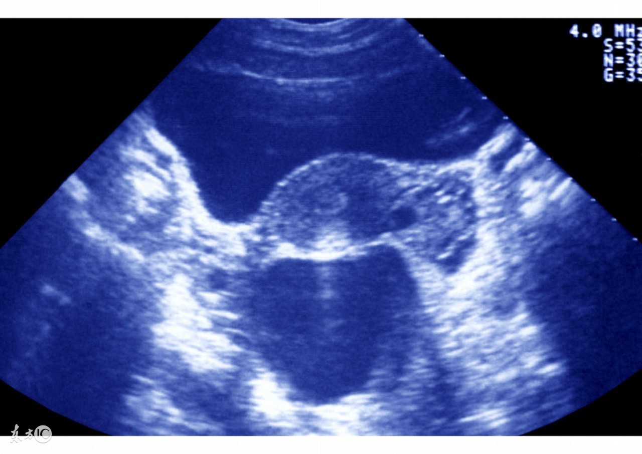 腹腔镜输卵管手术后怎么备孕,输卵管腹腔镜手术成功怀孕实例