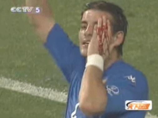 世界假球大赛名单,足球史上十大假球排名