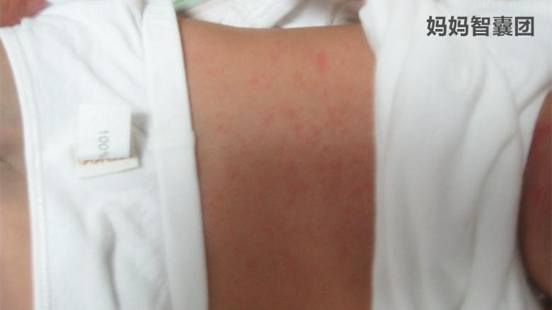 半岁宝宝持续高烧不退怎么办,6岁宝宝高烧三天不退