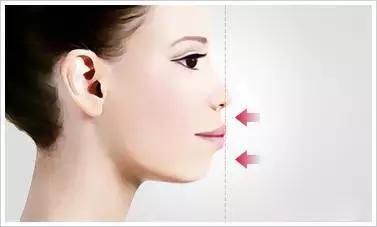 嘴突怎么治疗最有效,凸嘴快速改善方法