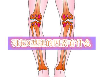 10宀佺敺瀛﹐鍨嬭吙鏄己閽欏悧鎬庢牱鐭,鐢熸椿涓摢浜涚粏鑺傚彲浠ョ煫姝鍨嬭吙