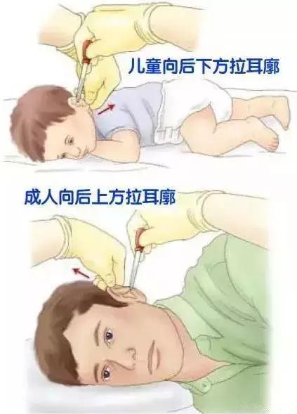 耳医生滴耳液正确使用方法,滴鼻药的正确姿势图解