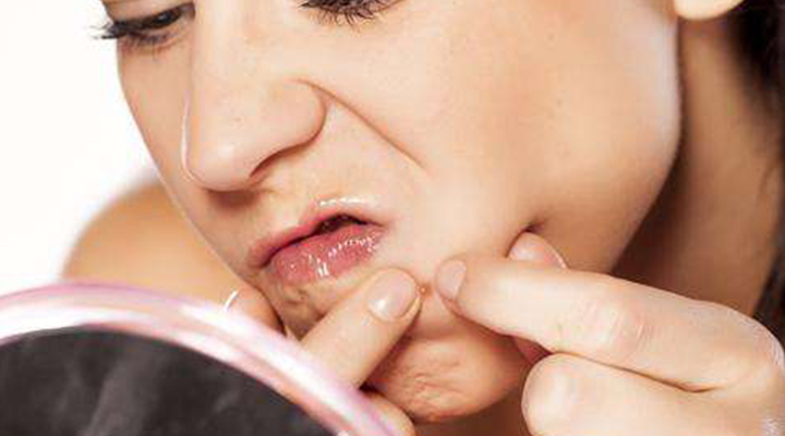 脸上和脖子上反复长痘痘什么原因,脸上反复长痘痘的原因和解决方法