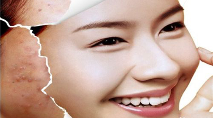 脸上和脖子上反复长痘痘什么原因,脸上反复长痘痘的原因和解决方法