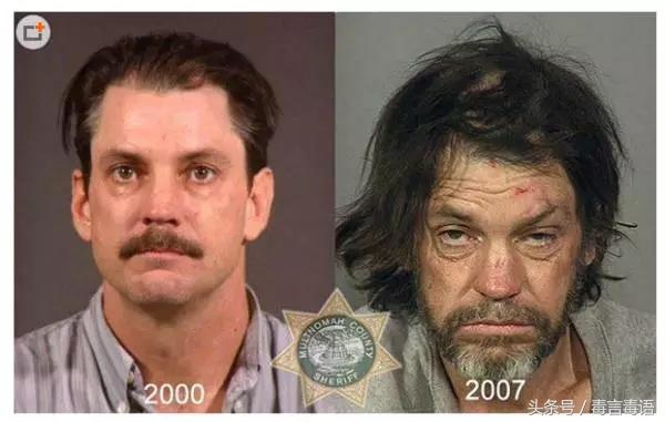 10个吸毒前后的惊人变化,吸毒的人吸毒前后对比图片