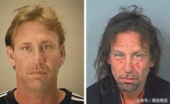 吸毒前后的变化对比,吸毒真的会毁容吗