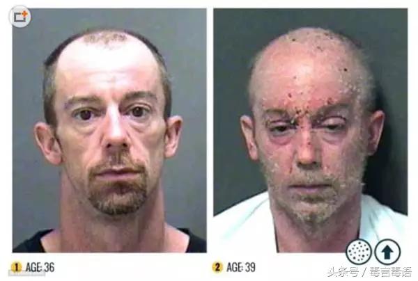 触目惊心吸毒前后真实的变化,吸毒的危害到底有多严重图片