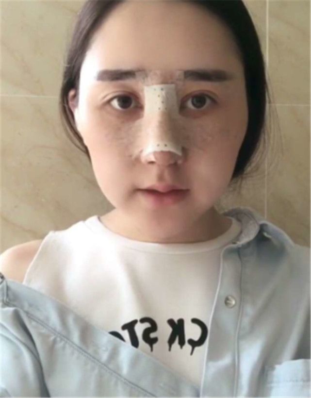 已婚女子被丈夫嫌弃“猪拱嘴”，悲愤整容，现成探探万人女神