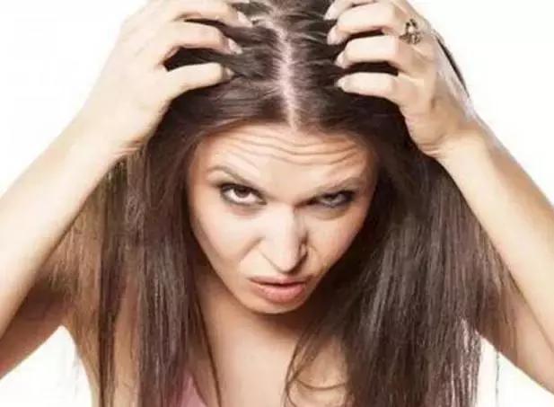 头皮痒头发油还大把脱发是怎么了,头油头皮痒脱发是什么原因