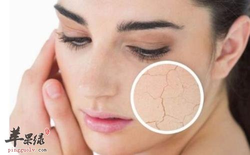 女人皮肤干燥如何保养,40岁女性皮肤干燥怎么调理最好