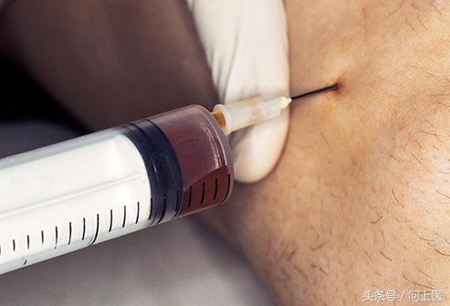 运动后膝盖疼痛的原因和解决方法,跑步后膝盖疼痛的原因和解决方法