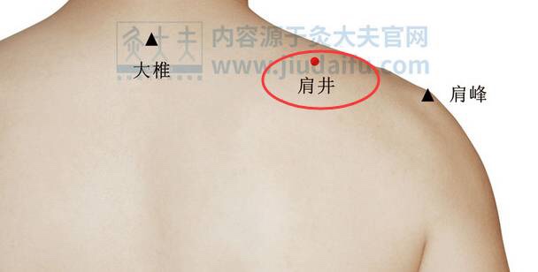 艾灸治疗肩周炎,是健康安全的优选方案