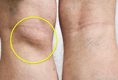 老年人膝盖疼痛的原因和治疗方法,膝盖疼痛的原因和解决方法