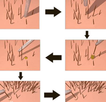 90后的叔叔阿姨，你的头发掉了