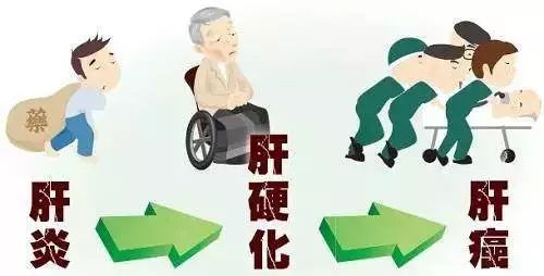 肝腹水的常见治疗误区有哪些,肝腹水治疗有哪几个误区