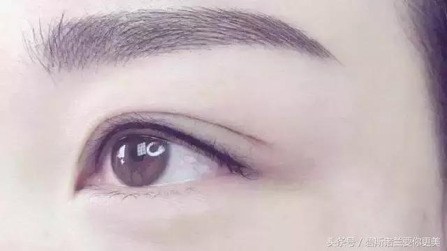 做了美瞳线双眼皮不见了,美瞳线做完1-7天肿胀的对比图