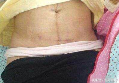 顺产真的比剖宫产好吗,顺产更疼还是剖腹产更疼